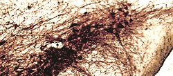 Targeting Parkinson’s-Linked Protein Could Neutralize 2 of the Disease’s Causes