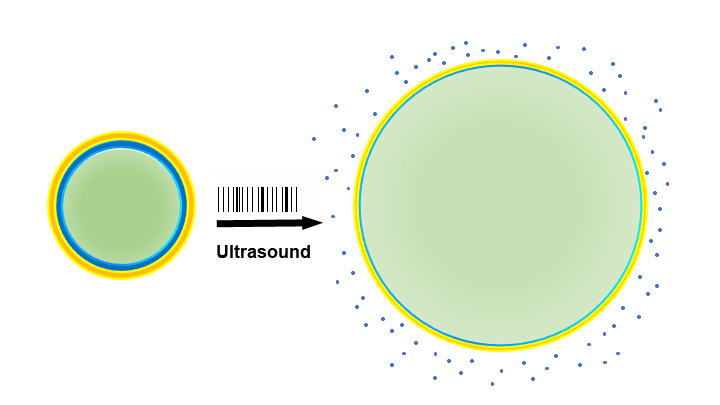 Noninvasive Ultrasound Pulses Used to Precisely Tweak Rat Brain Activity