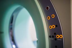 Brain structural changes linked to physical, mental health in functional neurological disorder (conversion disorder)